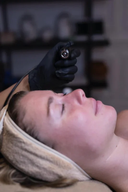 Face Reboot : Radiofrequence Visage & Needling Skin Repair (Femme & Homme) - Image 3